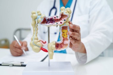 Bağırsak, hastanede teşhis ve tedavi için insan anatomisi modeli tutan doktor..