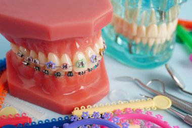 Ortodontik bağlar halkalar ve kravatlar, diş hekimliği üzerine çalışan dişçi için model..