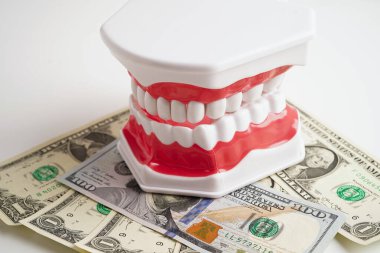 Diş implantı, çeneye yapay diş kökleri, diş tedavisinin kök kanalı, diş eti hastalığı, diş hekimliği üzerine çalışan dişçi modeli.