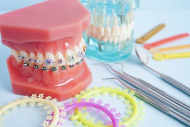 Ortodontik bağlar halkalar ve kravatlar, diş hekimliği üzerine çalışan dişçi için model..