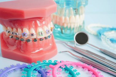 Ortodontik bağlar halkalar ve kravatlar, diş hekimliği üzerine çalışan dişçi için model..