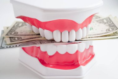 Diş tedavisi masrafları, diş masrafları ya da ücretler, diş modelli Amerikan doları paralar..
