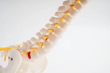 Omurga ve kemik, bel kemiği yerinden oynamış disk parçası, ortopedi bölümünde tedavi için model..