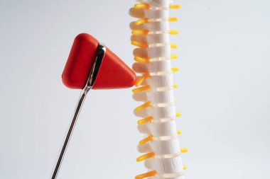 Omurga ve kemik, diz refleksi çekici, bel kemiği yerinden oynamış disk parçası, ortopedi bölümünde tedavi için model..