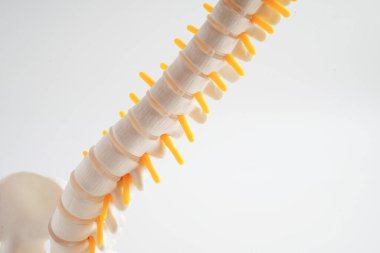 Omurga ve kemik, bel kemiği yerinden oynamış disk parçası, ortopedi bölümünde tedavi için model..