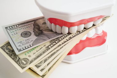 Diş tedavisi masrafları, diş masrafları ya da ücretler, diş modelli Amerikan doları paralar..