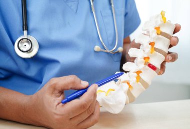 Omurga ve kemik modeli taşıyan Asyalı doktor, ortopedi bölümünde tedavi için bel kemiği yerinden oynamış disk parçası..