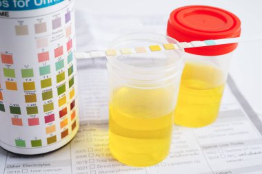 İdrar tahlili, reaksiyonlu idrar kabı. PH kağıt testi ve karşılaştırma tablosu laboratuvarda..