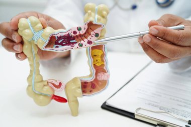 Bağırsak, hastanede teşhis ve tedavi için insan anatomisi modeli tutan doktor..