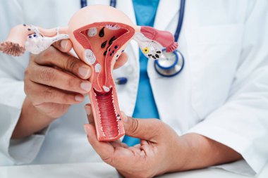 Rahim, hastanede teşhis ve tedavi için insan anatomisi modeli tutan doktor..