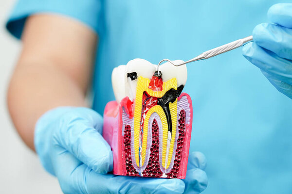 Dental implant, artificial tooth roots into jaw, root canal of dental treatment, gum disease, teeth model for dentist studying about dentistry.