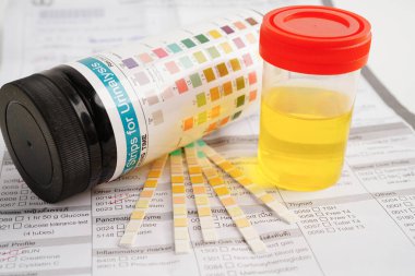 İdrar tahlili, reaksiyonlu idrar kabı. PH kağıt testi ve karşılaştırma tablosu laboratuvarda..