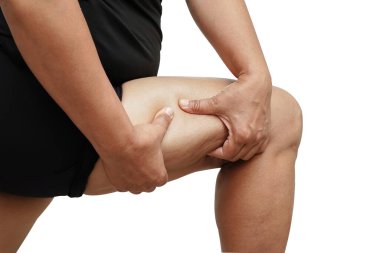 Bacağında selülit olan Asyalı bir kadın. Cilt yağlı. Kırpma yolu olan beyaz bir arka planda izole edilmiş..