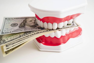 Diş tedavisi masrafları, diş masrafları ya da ücretler, diş modelli Amerikan doları paralar..