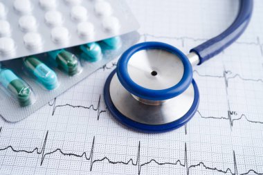 Stethoscope on electrocardiogram (ECG), heart wave, heart attack, cardiogram report.