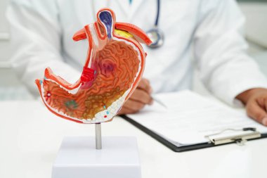 Mide hastalığı, hastanede teşhis ve tedavi için anatomi modeli tutan bir doktor..