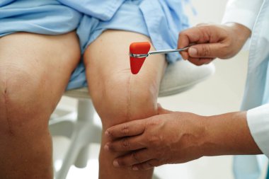 Asyalı doktor, hastanedeki yaşlı hastayı muayene etmek için diz refleksi sinirine vurdu..