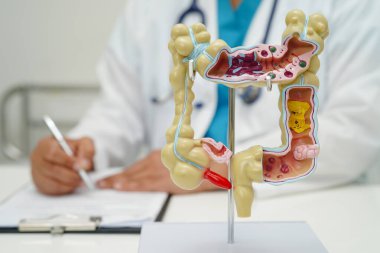 Bağırsak, hastanede teşhis ve tedavi için insan anatomisi modeli tutan doktor..