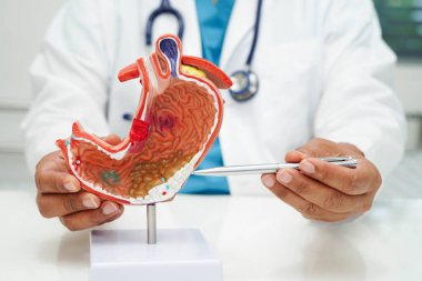 Mide hastalığı, hastanede teşhis ve tedavi için anatomi modeli tutan bir doktor..