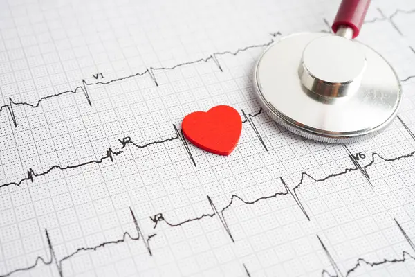 Stethoscope on electrocardiogram (ECG), heart wave, heart attack, cardiogram report.