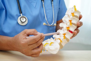 Omurga ve kemik modeli taşıyan Asyalı doktor, ortopedi bölümünde tedavi için bel kemiği yerinden oynamış disk parçası..