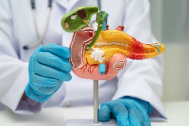 Pankreas iltihabı, pankreas hastası Asyalı doktor, safra kesesi ve safra kesesi insan anatomisi modeli..