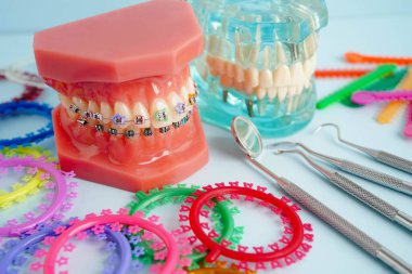 Ortodontik bağlar halkalar ve kravatlar, diş hekimliği üzerine çalışan dişçi için model..