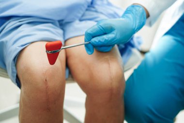 Asyalı doktor, hastanedeki yaşlı hastayı muayene etmek için diz refleksi sinirine vurdu..