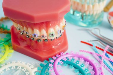 Orthodontic ligatures rings and ties, elastic rubber bands on orthodontic braces, model for dentist studying about dentistry. clipart