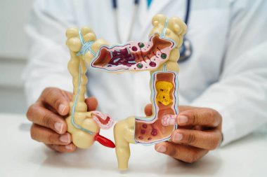Bağırsak, hastanede teşhis ve tedavi için insan anatomisi modeli tutan doktor..