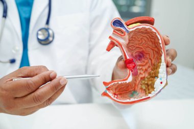 Mide hastalığı, hastanede teşhis ve tedavi için anatomi modeli tutan bir doktor..
