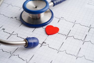 Stethoscope on electrocardiogram (ECG), heart wave, heart attack, cardiogram report.