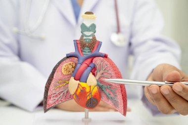 Zatürree, akciğer kanseri, Asyalı doktor hastanede teşhis ve tedavi için insan anatomisi modeli tutuyor.