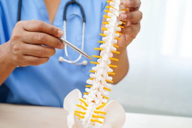 Omurga ve kemik modeli taşıyan Asyalı doktor, ortopedi bölümünde tedavi için bel kemiği yerinden oynamış disk parçası..