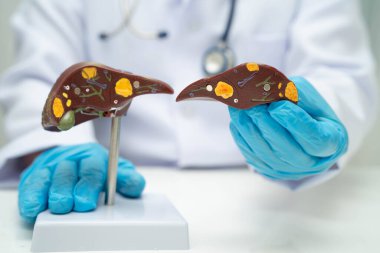 Safra kesesi, pankreas dalağı ve onikiparmak bağırsağı olan karaciğer, Asyalı doktor hastanede teşhis ve tedavi için insan anatomisi modeli tutuyor..