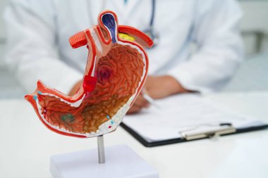 Mide hastalığı, hastanede teşhis ve tedavi için anatomi modeli tutan bir doktor..