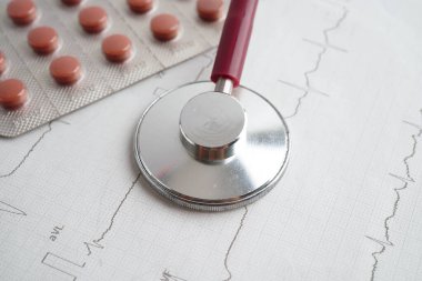 Elektrokardiyogram, EKG, kalp dalgası, kalp krizi, kardiyogram raporu.