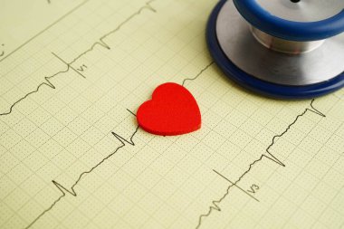 Stethoscope on electrocardiogram (ECG), heart wave, heart attack, cardiogram report.