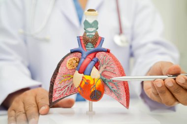 Zatürree, akciğer kanseri, Asyalı doktor hastanede teşhis ve tedavi için insan anatomisi modeli tutuyor.