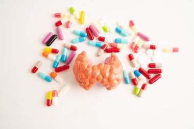 İlaç tedavisi gören tiroid modeli, Hipertiroidizm, Aşırı Aktif veya Lenfoma.