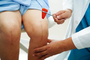 Asyalı doktor, hastanedeki yaşlı hastayı muayene etmek için diz refleksi sinirine vurdu..