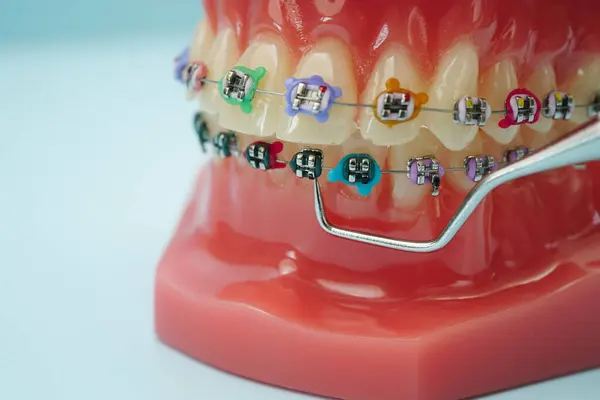 Diş hekimi ekipmanları, diş aletleri, diş sağlığı uzmanlarının diş tedavisi için kullandığı araçlar.