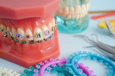 Ortodontik bağlar halkalar ve kravatlar, diş hekimliği üzerine çalışan dişçi için model..