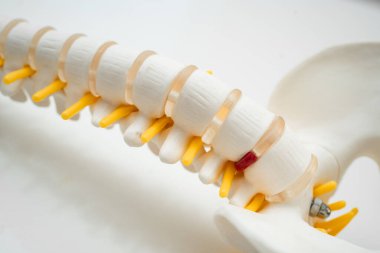 Omurga kemiği ve omurgalar arası diski olan bir insan..