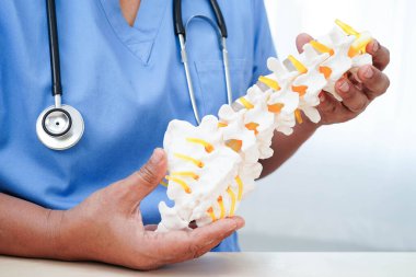 Omurga ve kemik modeli taşıyan Asyalı doktor, ortopedi bölümünde tedavi için bel kemiği yerinden oynamış disk parçası..