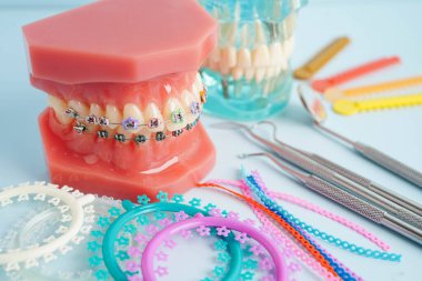 Ortodontik bağlar halkalar ve kravatlar, diş hekimliği üzerine çalışan dişçi için model..