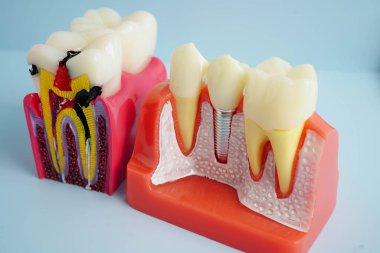 Diş hekimliği hakkında bilgi almak için beyaz arkaplanda diş modeli.