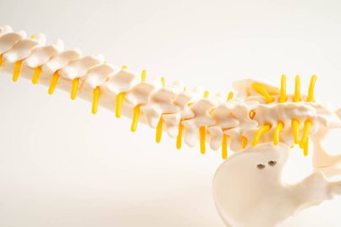 Omurga ve kemik, bel kemiği yerinden oynamış disk parçası, ortopedi bölümünde tedavi için model..