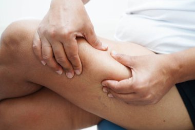 Bacağında selülit olan Asyalı bir kadın. Cildinde yağ, aşırı kilolu..