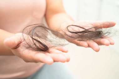 Asian woman have problem with long hair loss attach in her hand.